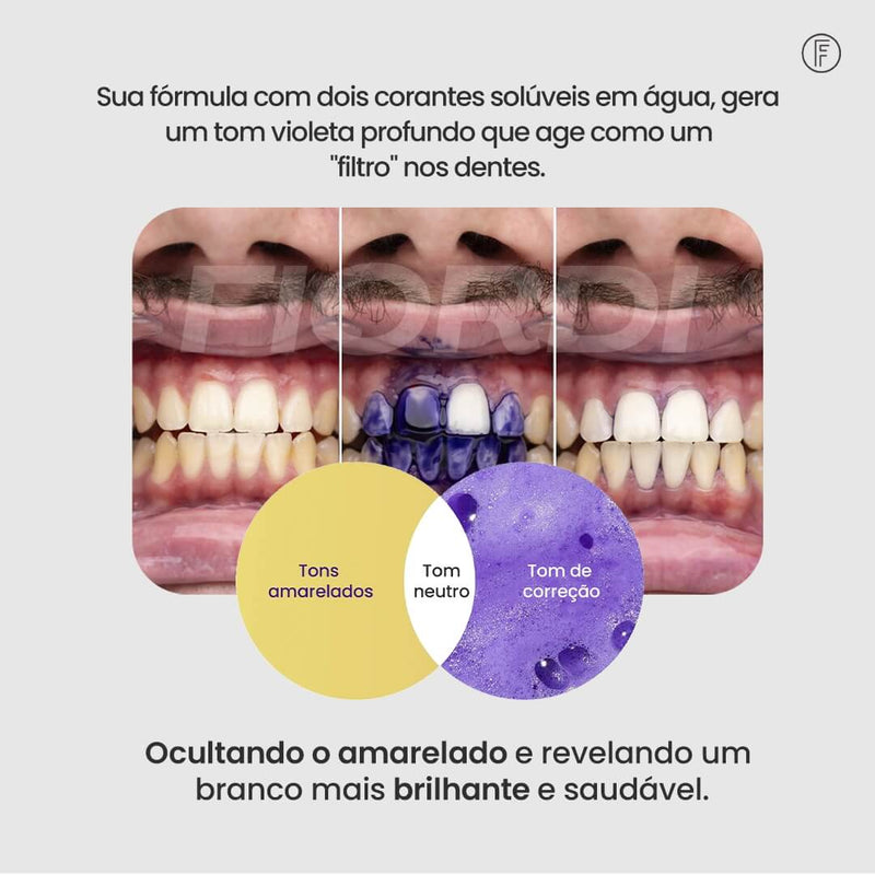 Sérum V34™ - Clareador Dentário + Brinde