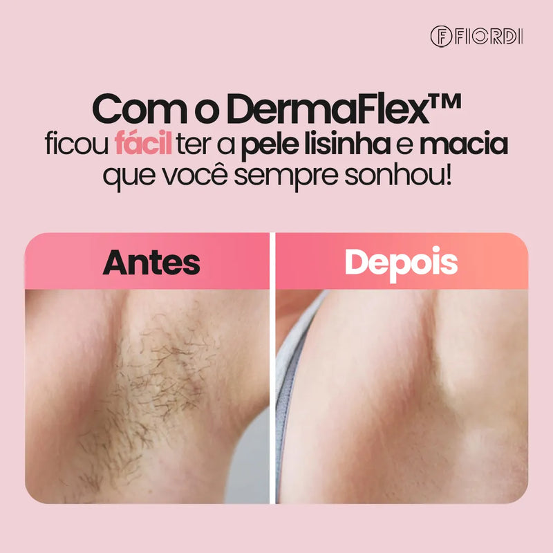 Depilador Elétrico 4 em 1 - DermaFlex®