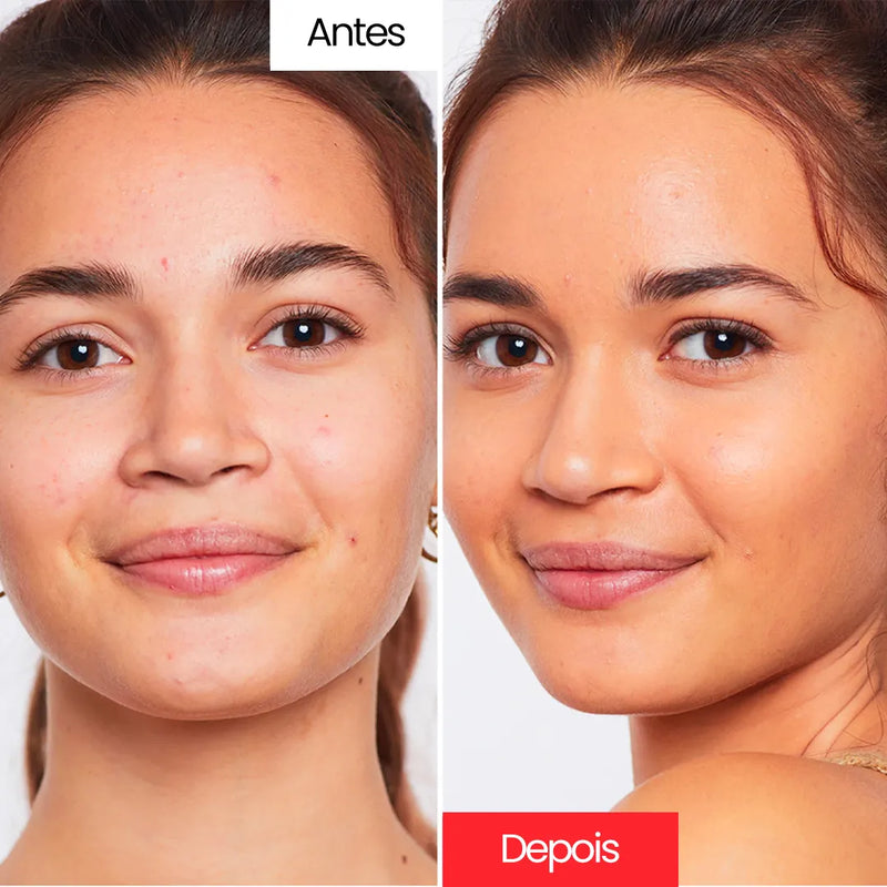 Creme Corretivo - Centella Cream™